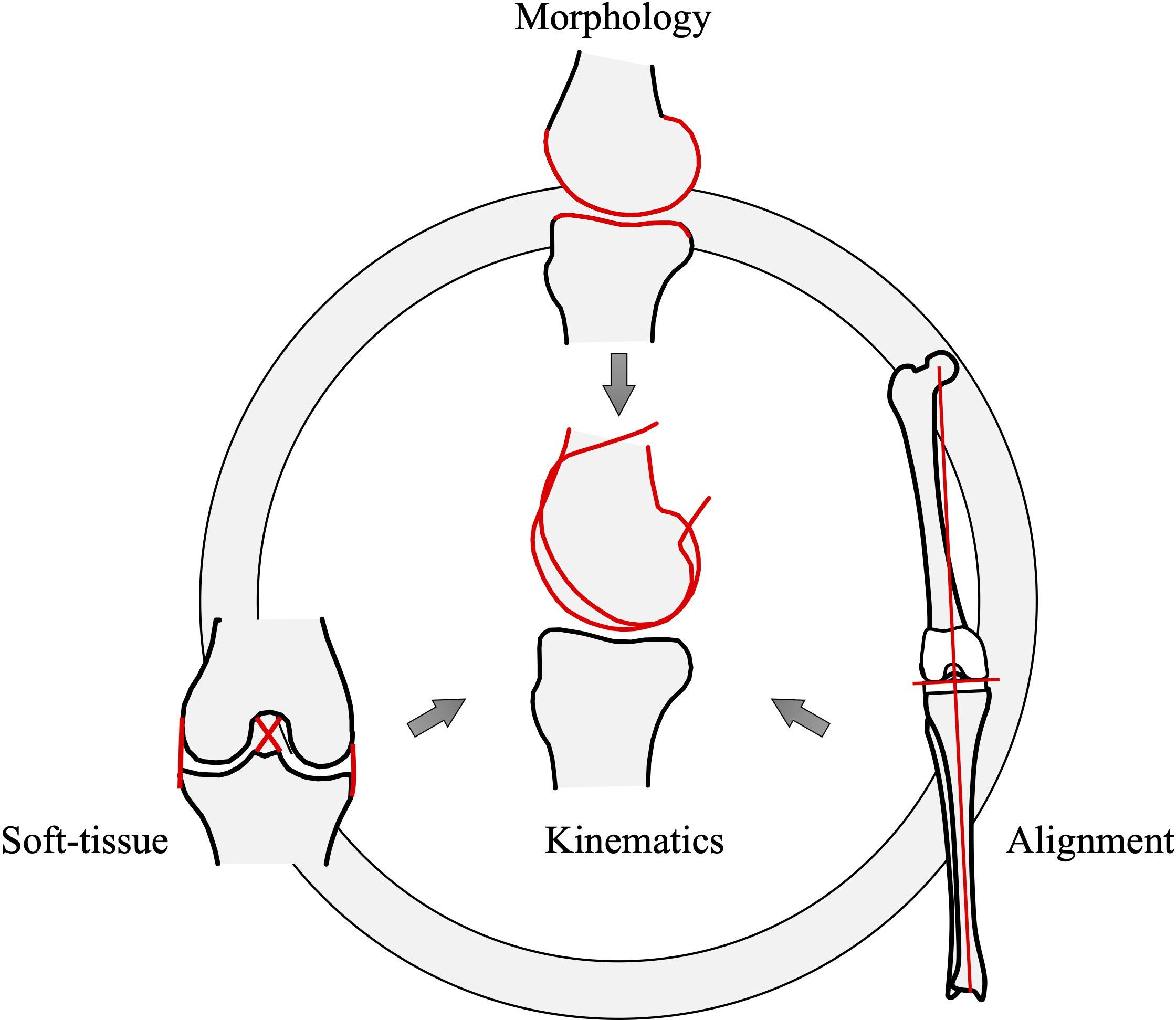Fig. 4 
            Three fundamental knee elements; morphology, alignment, and soft-tissue. Each element determines and is determined by the other two elements, creating the best harmony on an individual basis. As a result of this harmony, the individualized kinematics are provided. The mechanical approach tends to change all, while the kinematic approach aims to reproduce all. However, the starting point is different among the respective kinematic alignment (KA) approaches. The calipered approach starts from ‘morphology’, focusing on replicating the original articular surface. The soft-tissue respecting approach starts from the soft-tissue balance, and the restricted approach starts from the control of the alignment. All other elements are expected to be eventually overcome and the patients’ original kinematics will be restored. The functional alignment, inverse KA, and other computer-assisted approaches adjust all elements based on intraoperative measurements.
          